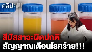 สีปัสสาวะผิดปกติ สัญญาณเตือนโรคร้าย | คลิป MU