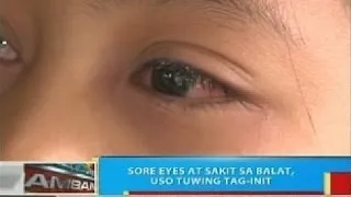 BP: Sore eyes at sakit sa balat, uso tuwing tag-init