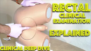 Rectal Examination and Prostate Exam - Digital Rectal Exam (DRE) - Medical School Clinical Skills