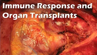 Immune Response and Organ Transplants
