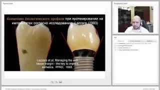 2015 02 10 История создания и особенности работы с имплантатами Any Ridge  0001