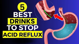 Top 5 Best Drinks To Stop Acid Reflux - Natural Remedies for Relieving Heartburn