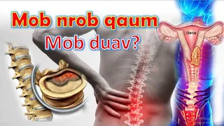 Mob nrob qaum/ Mob duav yog vim li cas?