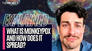 EXPLAINED: What Is The Monkeypox Virus And How Does It Spread?