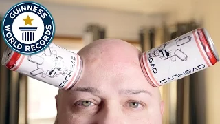 Can Head's skin sucks... literally - Guinness World Records