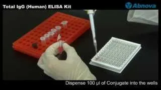 Total IgG (Human) ELISA Kit