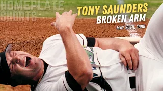 The Most PAINFUL Pitch in Baseball History | The Tony Saunders Story