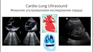 Фокусная кардио-пульмональная ультрасонография в условиях пандемии COVID 19