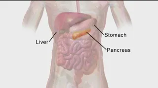 Battling pancreatic cancer | Doctor explains the disease