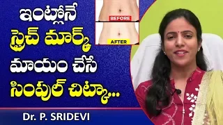 Stretch Marks Removal at Home in Telugu | Skin Care Tips | Dr Sri Devi | Doctors Tv