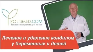 Лечение и удаление кондилом у беременных и детей салициловая кислота, фракция АСД, гомеопатия