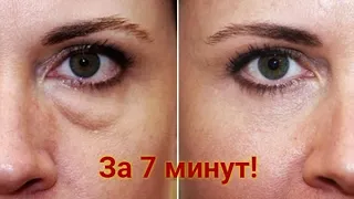 Bags and edema under the eyes. How to remove puffiness under the eyes? Recipe. 