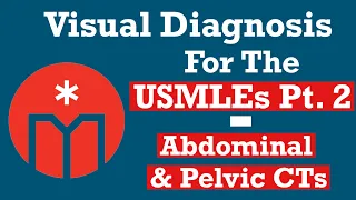 Visual Diagnosis for the USMLEs Part 2 — Abdominal & Pelvic CTs