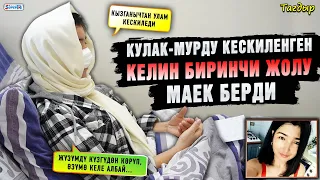 Кулак-мурду кескиленген келин биринчи жолу маек берди | “Кызганычтан улам кескиледи”