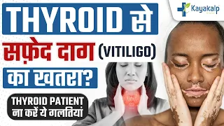 Thyroid से सफ़ेद दाग (Vitiligo) का खतरा? Thyroid Patient भूलकर भी ना करें ये गलतियां |Kayakalp Global