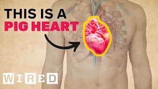 Doctor Breaks Down a Heart Transplant | WIRED