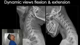 Imaging of normal Spine   Prof  Dr  Mamdouh Mahfouz