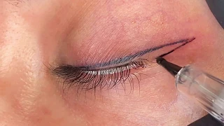 Permanent Eyeliner (Live Procedure) - Episode 14