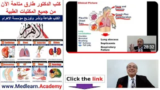 Pneumonia (I)  #cme #internal_medicine #medical #usmle #محاضرات_باطنة