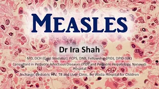 Dr Ira Shah : Measles
