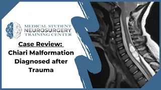 Case Review: Chiari Malformation Diagnosed after Trauma