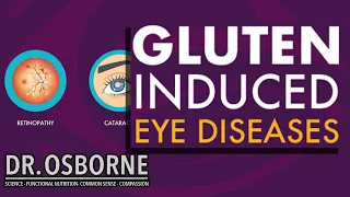 Gluten Induced Eye Diseases Related to Malnutrition/Malabsorption