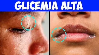 9 Segni Che La Tua Glicemia è Troppo Alta