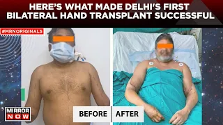 Deceased Woman Saves 4 Lives By Donating Her Organs | Delhi's First Bilateral Hand Transplant