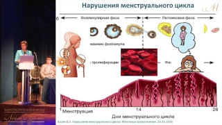 20 ноября 2016 г. Лекция "Нарушения менструального цикла. Маточные кровотечения у женщин"