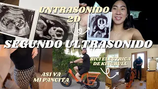 NUESTRO 2do ULTRASONIDO.. VIENDO AL BEBE EN 2D + NUEVA BICI ELECTRICA DE KINGBULL