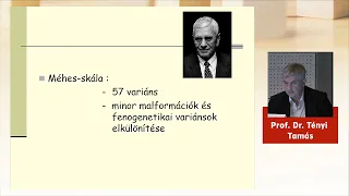 Prof. Dr. Tényi Tamás - Minor fizikális anomáliák vizsgálata idegfejlődési zavarokban