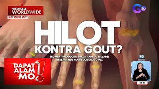 Gout, ginagamot gamit ang… hilot?! | Dapat Alam Mo!