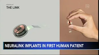 Neuralink implants brain chip in 1st human patient