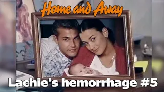 Lachie's Brain Hemorrhage (Part 5, Final) - 1998 - Home and Away