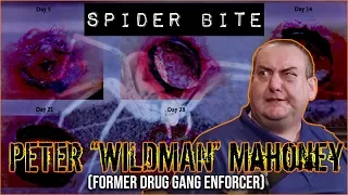 Q288: How Were Spiders In Arizona Jail? - Wild Man