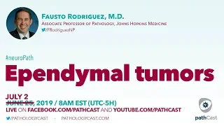 Ependymal tumors - Dr. Rodriguez (Hopkins) #NEUROPATH