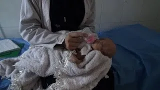 Hospital staff saves newborns after Aleppo air strike
