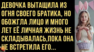 Вытащила из огня братика, но обожгла лицо и много лет личная жизнь не складывалась.История из жизни