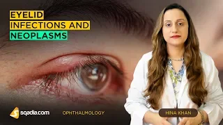 Eyelid Infections and Neoplasms | Ophthalmology Training Lecture | V-Learning