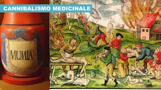 Il CANNIBALISMO “Medicinale” era comunissimo in EUROPA fino al XVII Secolo