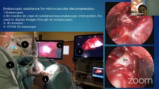 Neurosurgical Case Report (FCN, Tyumen, Russia)