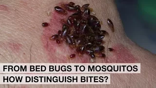 Bed Bugs in hostels, Mosquitos, Ticks, Fleas, Spiders and Scorpions: Bites and protection.