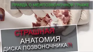 Правда про межпозвоночную грыжу. Анатомия позвоночника. Вертебролог Игнатьев Радион Геннадиевич.