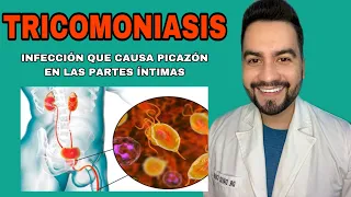 SI TIENES ESTE FLUJO ES PORQUE TE FUE INFIEL / Como se presenta la Tricomoniasis? | DR. DAVID CAMPOS