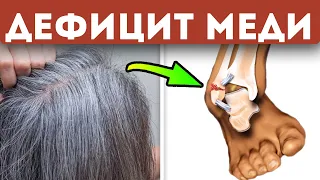 Секреты раскрыты! Вот какие последствия дефицита меди, и как его быстро восполнить