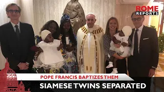 Pope Francis baptizes Siamese twins separated in Vatican pediatric hospital