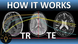 TR, TE & MRI Image Weighting EXPLAINED | MRI Physics Course Lecture 7