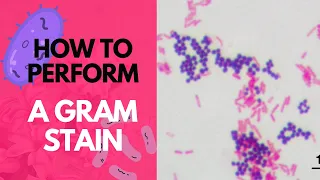 How to Perform a Gram Stain-Microbiology