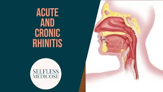 CHRONIC RHINITIS part 3 atrophic rhinitis, important seq, easy explanation