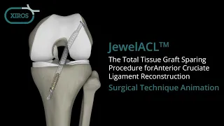JewelACL™ Total Tissue Graft Sparing Surgical Technique Animation